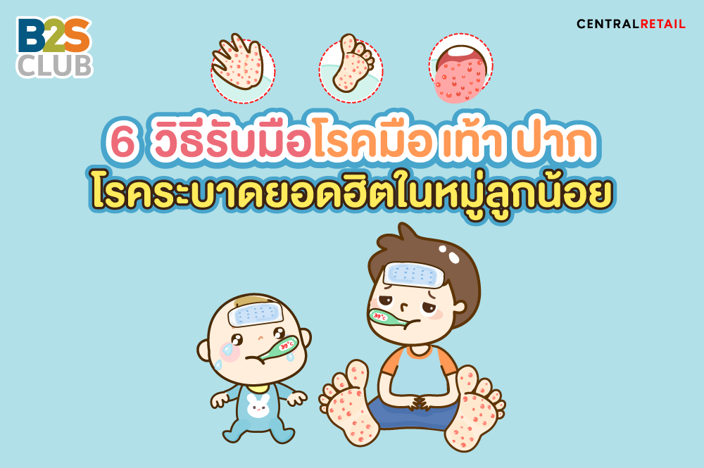 6 วิธีรับมือโรคมือ เท้า ปาก​ โรคระบาดยอดฮิตในหมู่ลูกน้อย​ ​